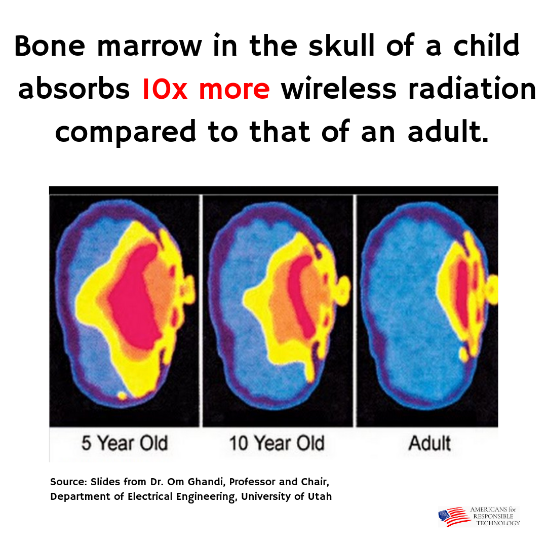 Radiation and Children